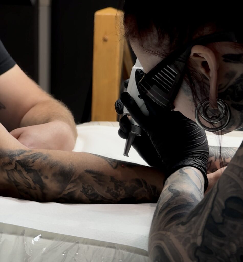 Osoba wykonująca laserowe usuwanie tatuażu na przedramieniu klienta w INK‑OGNITO Tattoo Rybnik